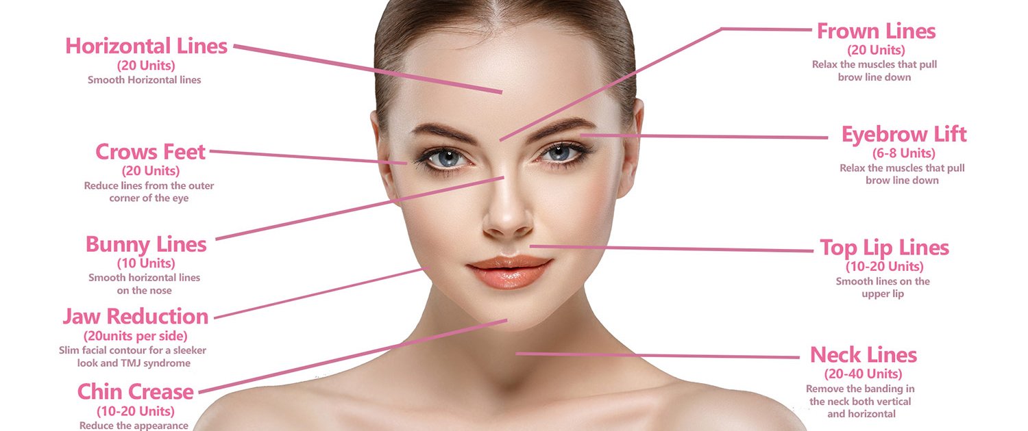 botox behandling